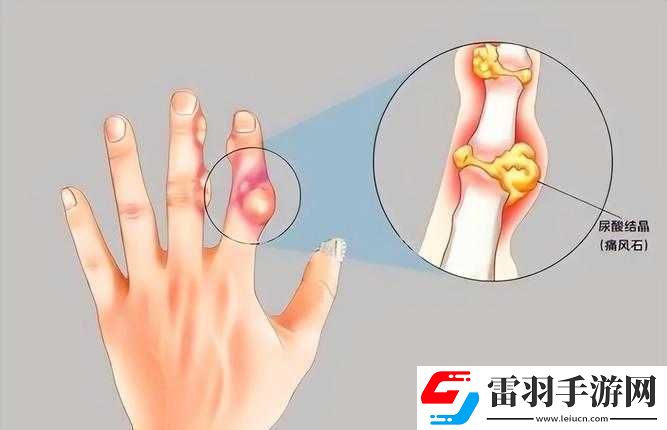 才三根手指就痛