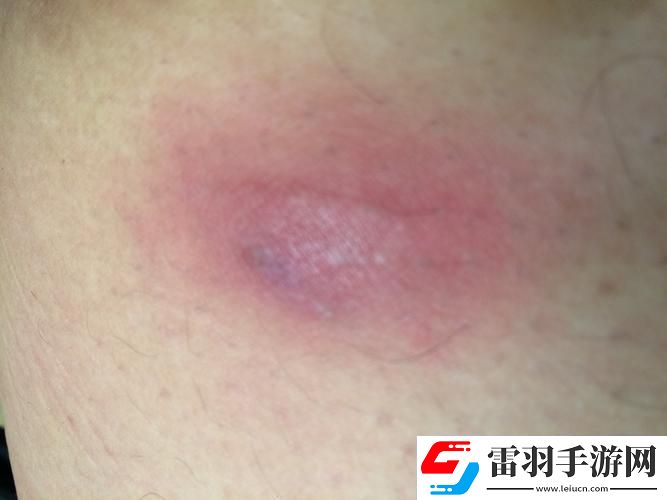 科技江湖突現(xiàn)「身體疙瘩俠」