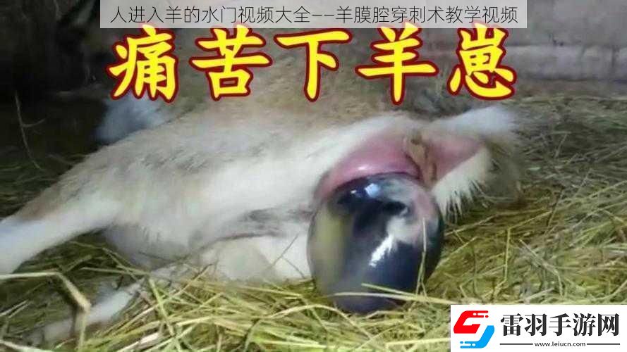人進入羊的水門視頻大全——羊膜腔穿刺術(shù)教學(xué)視頻